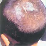 ������ͷѢ 