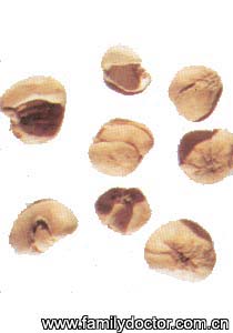 ������ĸBulbusFritillariaeHupehensis/������ĸ  Bulbus Fritillariae Hupehensis 