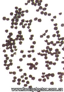 ������SemenCelosiae/������ Semen Celosiae 