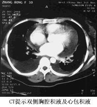 ˫����ǻ��Һ���İ���Һ