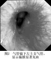 ˫����ǻ��Һ���İ���Һ