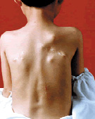 �����Թǻ���ά��������