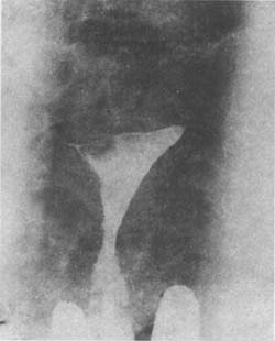 �ӹ�����