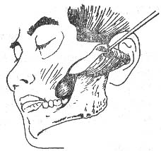 ҧ����϶��Ⱦ