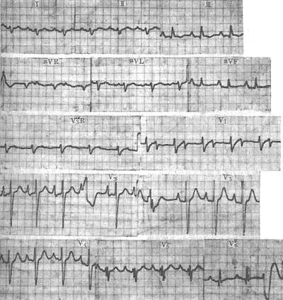 �������ļ���