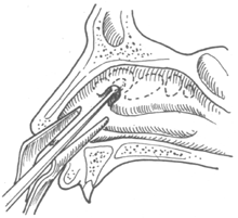 ����ɸ���