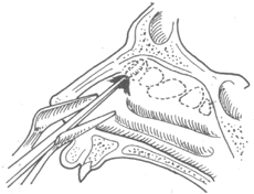 ����ɸ���