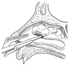 ����ɸ���