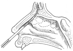 ����ɸ���