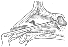 ����ɸ���