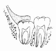 �ǳݹ�����