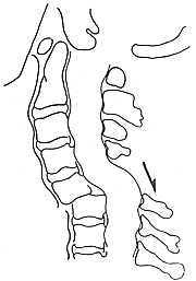 �޼������˵ľ�׵������λ