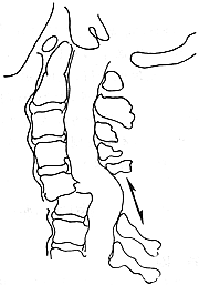 �޼������˵ľ�׵������λ