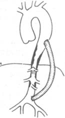 �෢�Դ�����