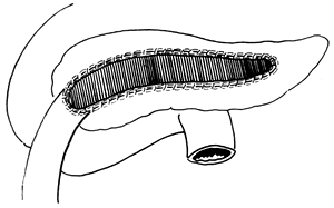 ���������ף���ƣ�