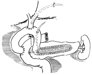 ���������ף���ƣ�