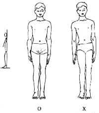 ������͹