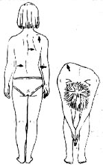 ������͹