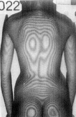 ������͹