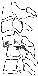 ����ؽ�ͻ�ؽ���λ