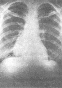 ��֢����������ƣ�