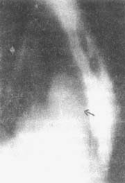 ��֢����������ƣ�