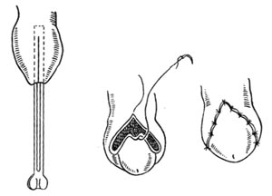 ��Ƥ��ͷ��