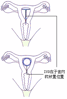 ���ڽ����� 