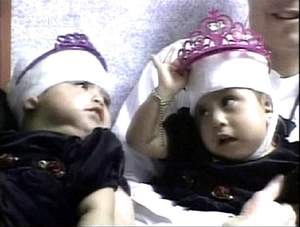 ��ͷӤ��ͷ�����������ɹ�//