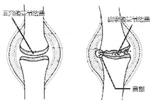 2002���ٴ�ҽѧ��չ�ع˹ǿ�ѧ//