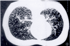 t3406.gif (11977 bytes)