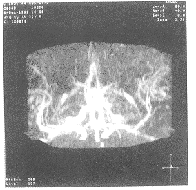 tb1.gif (24906 bytes)