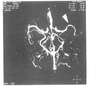 tb103.gif (22356 bytes)