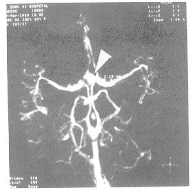 tb104.gif (24903 bytes)