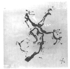 tb105.gif (22211 bytes)