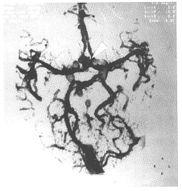 tb106.gif (21736 bytes)