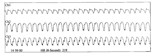 t30101.gif (8036 bytes)