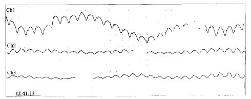 t30102.gif (4328 bytes)