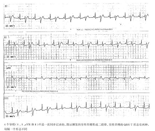 t30301.gif (36612 bytes)