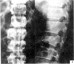 176-t.gif (13321 bytes)