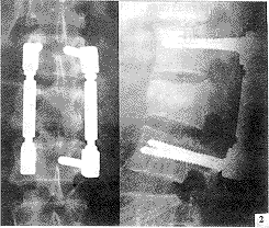 177-t1.gif (12113 bytes)