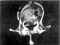 177-t2.gif (8076 bytes)