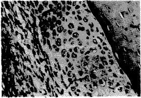 t357a.gif (10348 bytes)