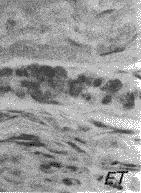 t41-2.gif (6483 �ֽ�)