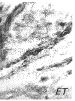 t42-4.gif (6659 �ֽ�)