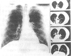 1-1.gif (10102 bytes)