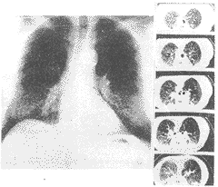 1-2.gif (9093 bytes)