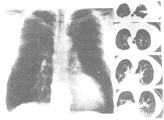 1-3.gif (8030 bytes)