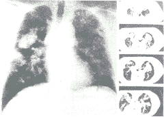 1-4.gif (7167 bytes)