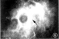 34-6.gif (6438 bytes)